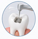 Conservative Dentistry