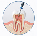 Endodontics
