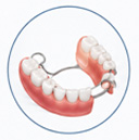 Removable Prosthesis