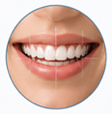 Smile Designing